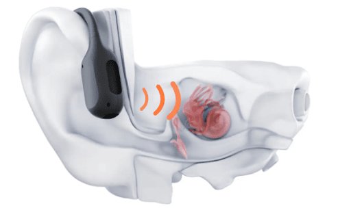 Bone Conduction Headphones: Your Ultimate Guide to the Best Choice
